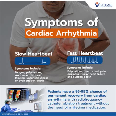 arrhythmia heart attack